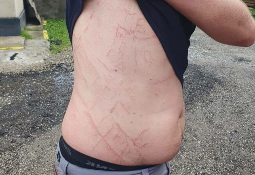 UN ARGEȘEAN A SCĂPAT CA PRIN MINUNE DUPĂ CE A FOST LOVIT DE UN TRĂZNET ÎN MUNȚII ARGEȘULUI