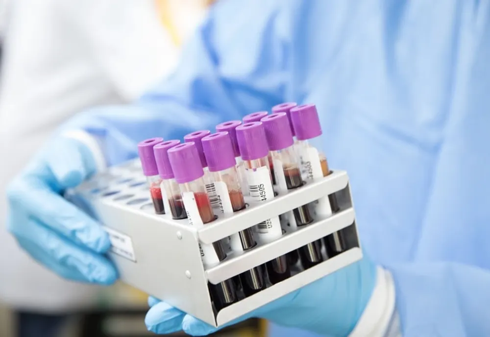 34 pacienți cu coronavirus în Argeș