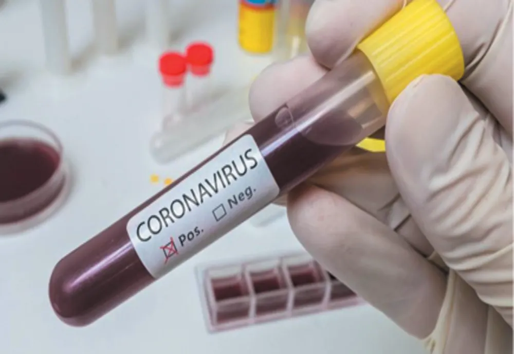 Comisarul șef al Poliţiei din Mioveni are coronavirus