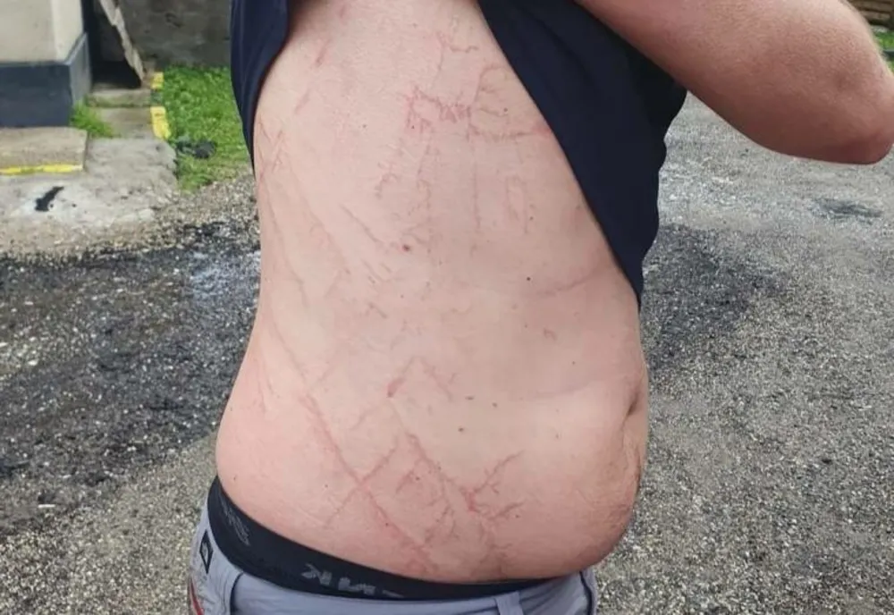 UN ARGEȘEAN A SCĂPAT CA PRIN MINUNE DUPĂ CE A FOST LOVIT DE UN TRĂZNET ÎN MUNȚII ARGEȘULUI