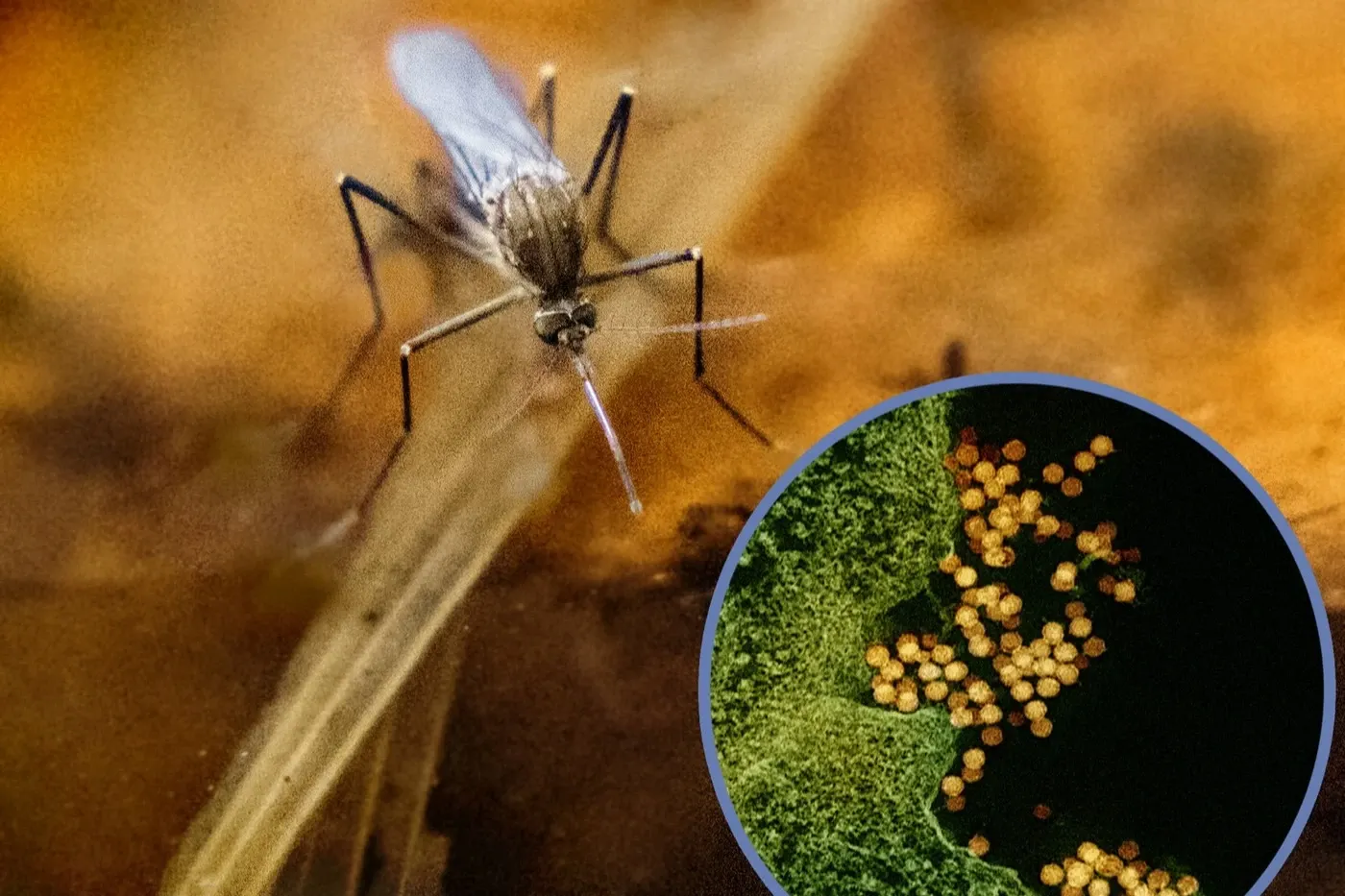 Virusul West Nile