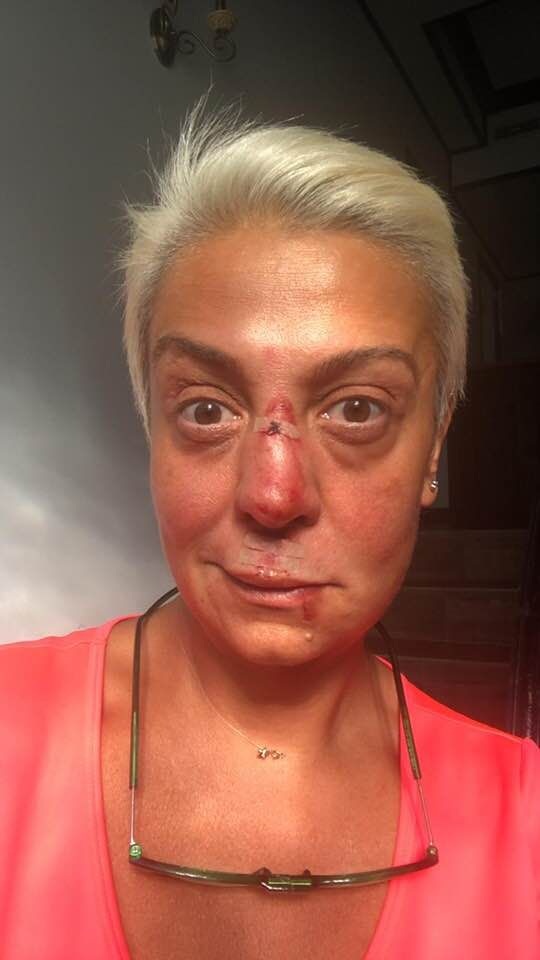 Monica Anghel lovită la echitație