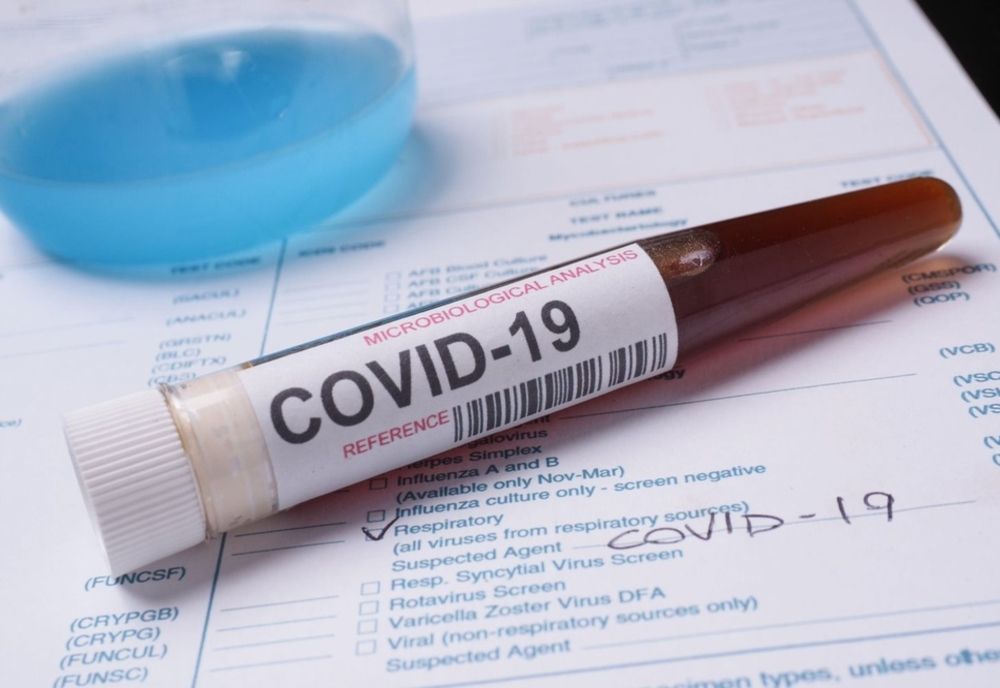 Argeș: 238 cazuri de coronavirus!