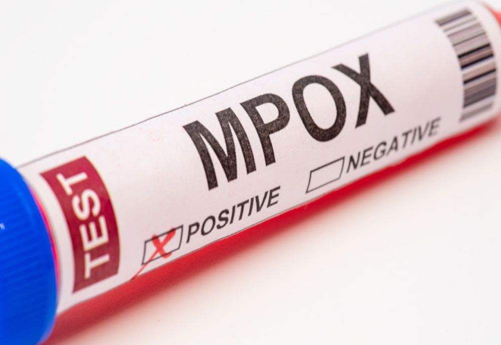 FRANȚA RAPORTEAZĂ UN PRIM CAZ AL NOII VARIANTE DE MPOX