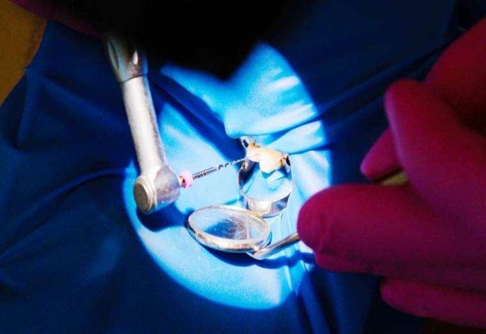 IMPORTANȚA COROANEI DENTARE ÎN RESTAURAREA ZÂMBETULUI