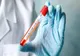 Două decese raportate într-o zi! 13 morți de coronavirus în Argeș!