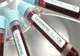 Numărul cazurilor de coronavirus a ajuns la 188 în Argeș