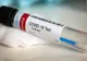 Bilanț coronavirus 25 noiembrie: 2.104 cazuri noi și 212 decese dintre care 35 anterioare